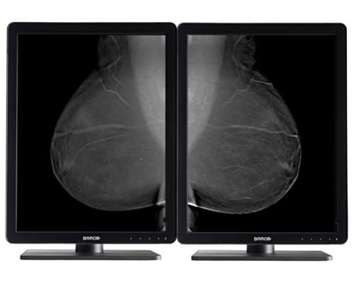 2 x BARCO Nio 5 MP MDNG-5221