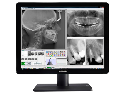 Monitor BARCO Nio Color 2MPix MDNC-2123 Dental
