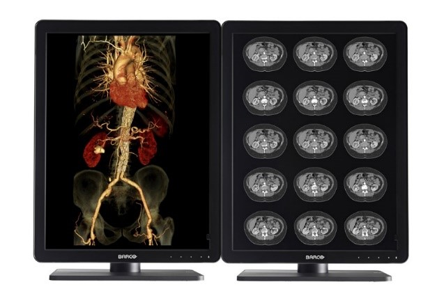 rentgen dwumonitorowe 2