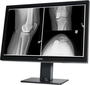 rentgen jednomonitorowe 1