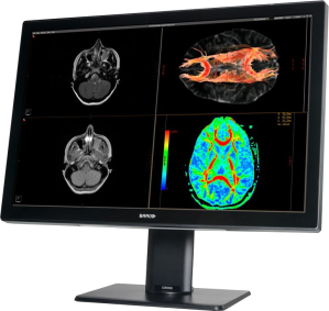 rentgen jednomonitorowe 2